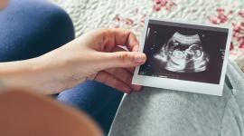 5 Important Factors When Choosing an IVF Egg Donation Programme